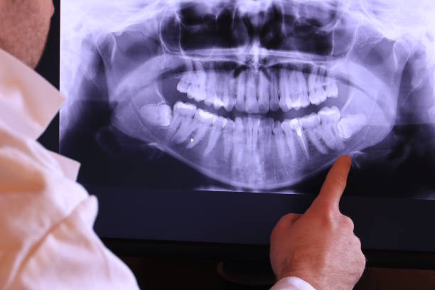 Best Emergency Dental Care for Broken or Chipped Teeth in Evadale, TX